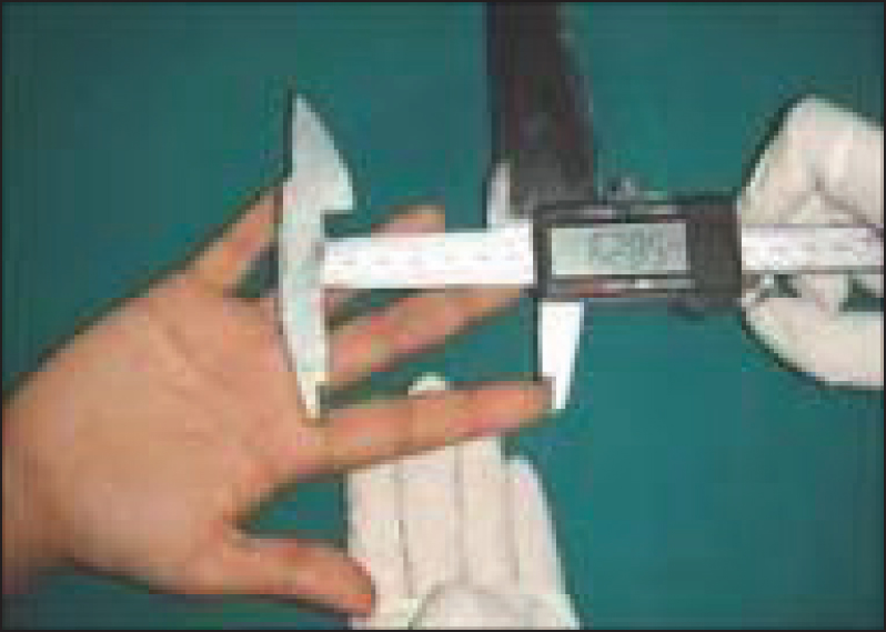 Figure 1: Picture showing measurement of the index and ring finger lengths with a Vernier caliper