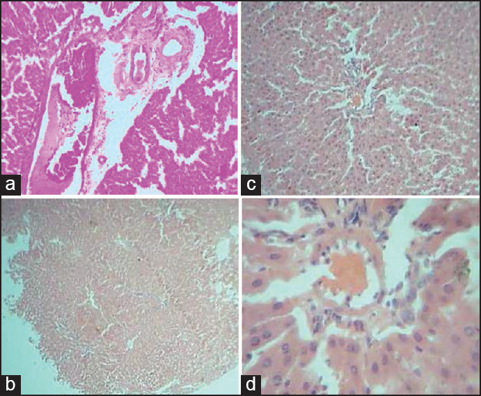 Figure 1: Comparative histology illustrations of the mammalian liver. (a) Section of the Liver of <i>rattus norvergicus</i> showing hepatocytes (he), and portal triad (pt) H&E × 100 (b) Section of the Liver of <i>rattus norvergicus Gallus gallus domesticus domesticus agama aculeata sp rana tigrinas clarias gariepinus</i> showing hepatocytes (he) disposed in cord and sheet H&E × 40 (c) Section of the Liver of <i>rattus norvergicus</i> showing hepatocytes (he) disposed in cord and sheet. A prominent central venules (cv) is present in the center H&E × 100 (d) Section of the liver of <i>rattus norvergicus</i> showing hepatocytes (he) disposed in cord and sheet. A prominent central venules (cv) is present in the center H&E × 400