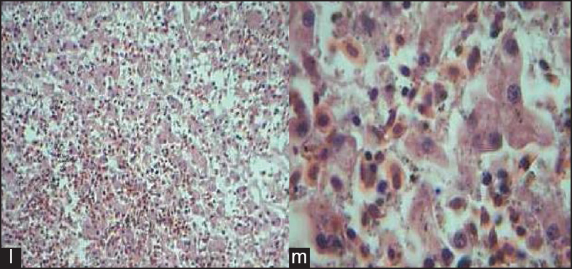 Figure 4: Comparative histology illustrations of the amphibian liver. (l) Section of the liver of <i>Rana tigrinas</i> showing hepatocytes disposed in singles and cluster, separated by a loose fibrovascular connective tissue stroma. Nucleated red cells are within the intervening sinusoids H&E × 100 (m) Section of the liver of <i>Rana tigrinas</i> showing hepatocytes disposed in singles and cluster, separated by a loose fibrovascular connective tissue stroma. Nucleatedred cells are within the intervening sinusoids H&E × 400