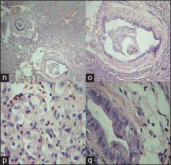 Figure 5: Comparative histology illustrations of the fish liver. (n) Section of the liver of <i>Clarias gariepinus</i> showing sheets and clusters of hepatocytes H&E × 40 (o) Section of the liver of <i>Clarias gariepinus</i> showing a biliary duct within the liver parenchyma with kuffer cell (kc), H&E × 100 (p) Section of the liver of <i>Clarias gariepinus</i> showing hepatocytes disposed in clusters (he). Few nucleated red cells (rc) are seen in the background H&E × 400 (q) Section of the liver of <i>Clarias gariepinus</i> showing a biliary duct (bd) with straitified columnar epithelium. Few hepatocytes and nucleated red cell are seen in the periphery (H&E × 400)