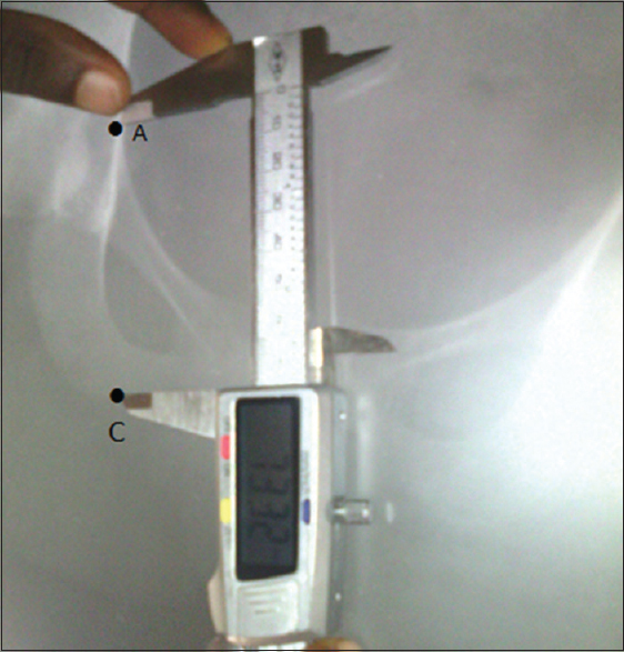 Figure 2: Measurement of ischial length (AC)