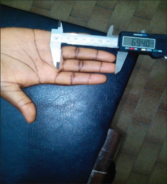 Figure 1: Picture of right fourth digit being measured