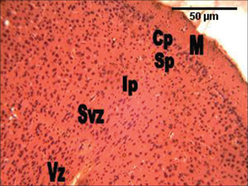 Figure 2: The photomicrograph of the cerebral cortex of the control group showing the marginal zone containing mostly processes, with sparse cell density. The cortical plate shows much cell density. The subcortical plate has less cellular density. The intermediate, subventricular and the ventricular zones are not distinguishable, with the layers showing numerous cellular densities. M = Marginal zone; Cp = Cortical plate; Sp = Subcortical plate; Ip = Intermediate; Svz = Sub-ventricular; and the Vz = Ventricular zones (H and E, ×100)