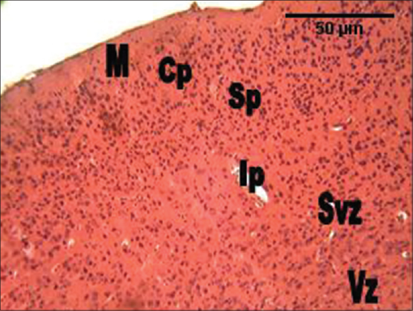 Figure 3: The photomicrograph of the cerebral cortex of the group administered <i>Rauvolfia vomitoria</i> (RV) alone showing more cellular density, and smaller cellular sizes compared with the control group. M = Marginal zone; Cp = Cortical plate; Sp = Subcortical plate; Ip = Intermediate; Svz = Sub-ventricular; and the Vz = Ventricular zones (H and E, ×100)