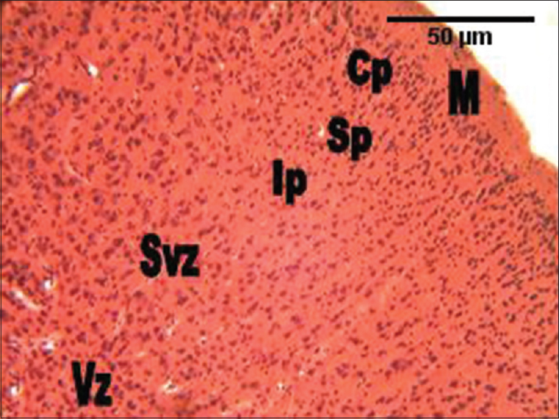 Figure 4: The photomicrograph of the cerebral cortex of the group administered <i>Gongronema latifolium</i> alone showing much cellular density and smaller cellular sizes in all the cortical layers compared with the control group. M = Marginal zone; Cp = Cortical plate; Sp = Subcortical plate; Ip = Intermediate; Svz = Subventricular; and the Vz = Ventricular zones (H and E, ×100)