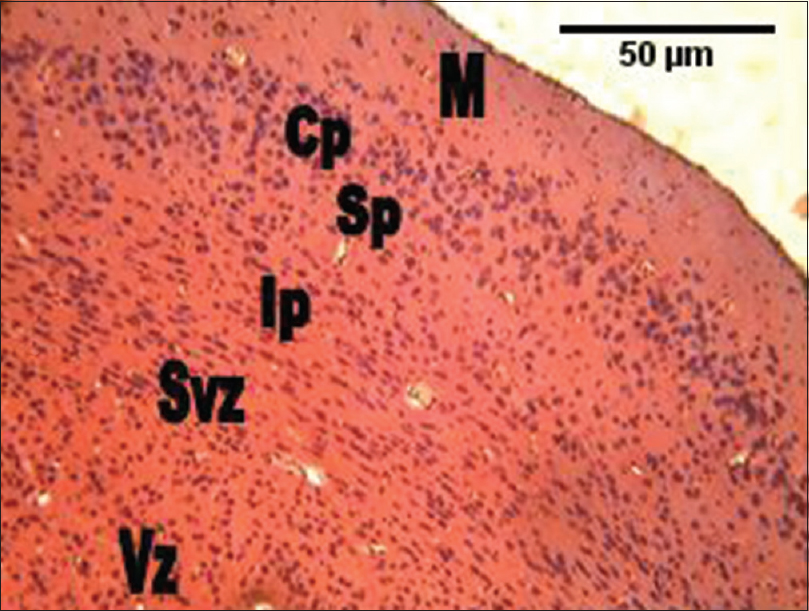Figure 5: The photomicrograph of the cerebral cortex of the group administered the combination of <i>Rauvolfia vomitoria</i> and <i>Gongronema latifolium</i> (<i>Rauvolfia vomitoria</i>+ <i>Gongronema latifolium</i>) showing much cellular density, but smaller cellular sizes in the intermediate zones through to the ventricular zones. However, the cortical cells were slightly larger compared with the control group. M = Marginal zone; Cp = Cortical plate; Sp = Subcortical plate; Ip = Intermediate; Svz = Sub-ventricular; and the Vz = Ventricular zones (H and E, ×100)