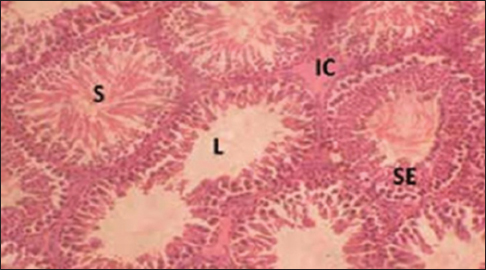 Figure 2: Cross-section of the testis of group that inhaled gloss paint3 weeks) (for Stain: Hematoxylin andeosin,Magnification: ×200, 3 weeks) Stain: Hematoxylin and eosin, Magnification: ×200, ST = Seminiferous tubules, IC = Interstitial cells, S = Spermatozoa, L = Lumen, SE = Spermatogenic epithelium