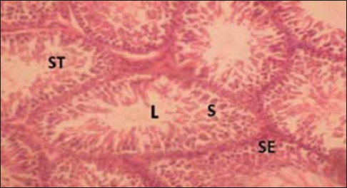 Figure 3: Cross section of the testis of the group that inhaled Nitrocellulose thinner (for 3 weeks). Stain: Hematoxylin and eosin. Magnification: ×200. ST = Seminiferous tubule, L = Lumen, S = Spermatozoa, SE = Spermatogenic epithelium