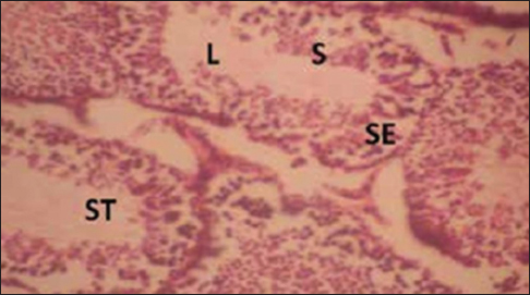 Figure 4: Cross section of the tests of the group that inhaled emulsion paint (for 3 weeks). Stain: Hematoxylin and eosin, Magnification: ×200. ST = Seminiferous tubule, S = Spermatozoa, L = Lumen, SE = Spermatogenic epithelium