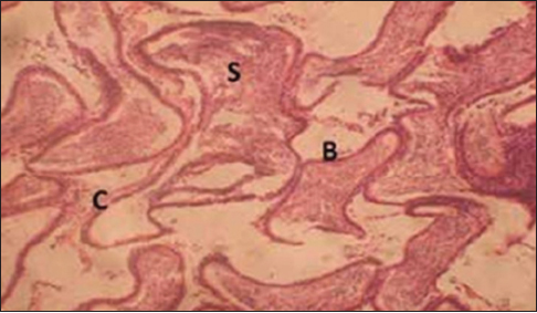 Figure 6: Cross section of the epididymis of the group that inhaled gloss paints (for 3 weeks). Stain: Hematoxylin and eosin. Magnification: ×200. S = Spermatozoa, B = Basal cells, C = Columnar cells