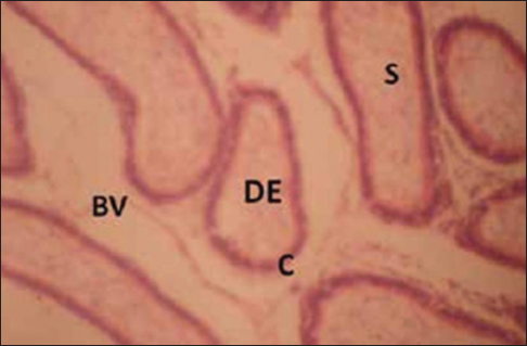 Figure 7: Cross-section of the epididymis of group that inhaled nitrocellulose thinner (3 weeks). Stain: Hematoxylin and eosin, Magnification: ×200, S = Spermatozoa, BV = Blood vessels, C = Columnar cells, DE = Duct of the epididymis