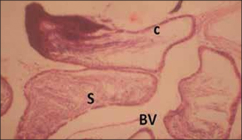 Figure 8: Cross section of the epididymis of the group that inhaled emulsion paint (for 3 weeks). Stain: Hematoxylin and eosin. Magnification: ×200. S = Spermatozoa, BV = Blood vessels, C = Columnar cells