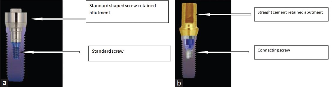 Figure 1: (a) Standard abutment for a screw-retained abutment; (b) Abutment for a cement-retained restoration