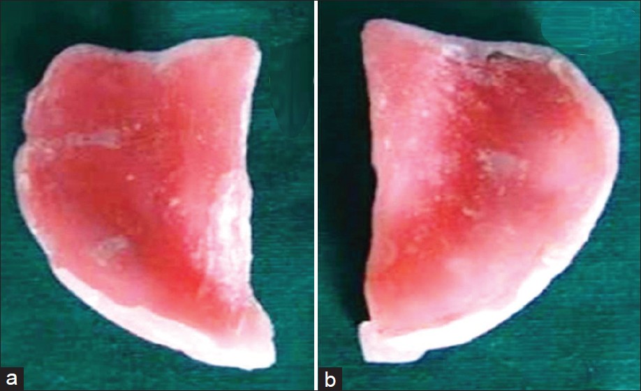 Figure 3: (a and b) Sectioned maxillary custom tray