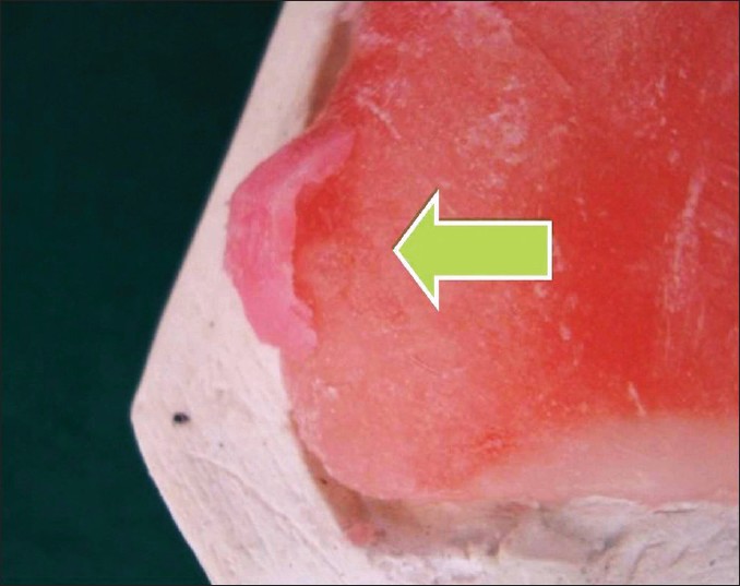 Figure 6: Crevices for tongue blade