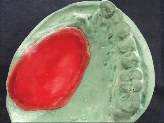 Figure 4: Wax lid sealed