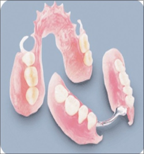 Figure 3: An interim denture