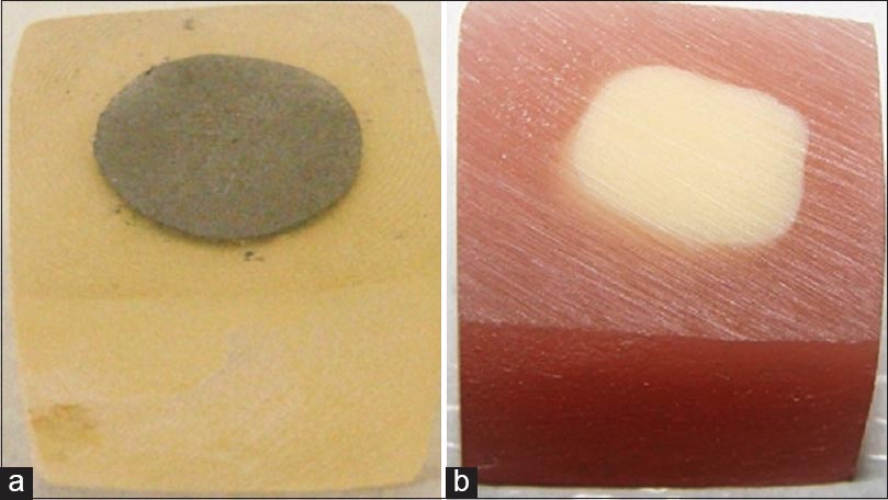 Figure 1: A sample with framework alloy (a) and denture tooth (b), before acrylic resin polymerization