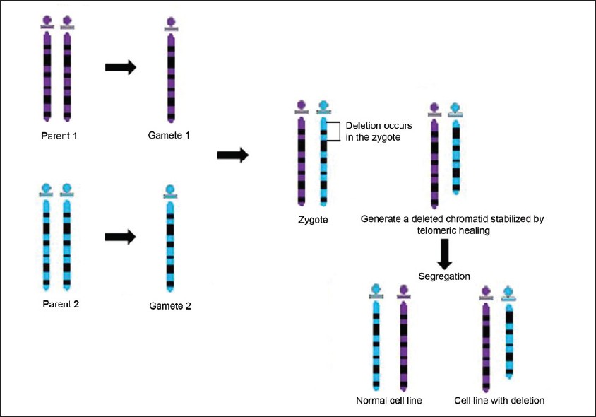 Figure 3: Suggested mechanism for the formation of mosaic cell lines in chromosomal deletions