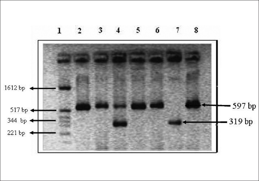 Figure 1: ACE genotypes as observed on a 2% agarose gel containing ethidium bromide Illustrating homozygous DD, homozygous II and heterozygous ID genotype of ACE gene. Lane 1: DNA ladder (pBR322/HinfI digest), Lane 2-3, 5-6 and 8: homozygous II genotype, Lane 4: heterozygous ID genotype, Lane 7: homozygous DD genotype