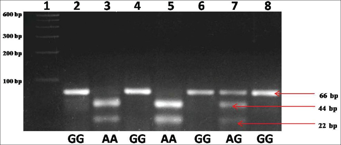 Figure 1: Agarose gel picture showing NdeI digested different methionine synthase reductase genotypes