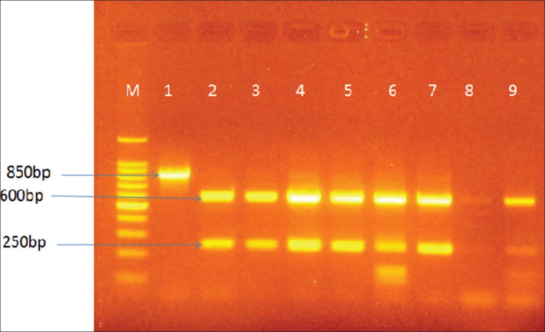 Figure 1: Agarose gel electrophoresis showing digestion of the 850 bp PCR product by the Dde1 restriction endonuclease. Legend Lane M is the 100 bp DNA ladder Lane 1 is the PCR product Lane 2 is the homozygous AA individual Lane 6 is the heterozygous AC individual