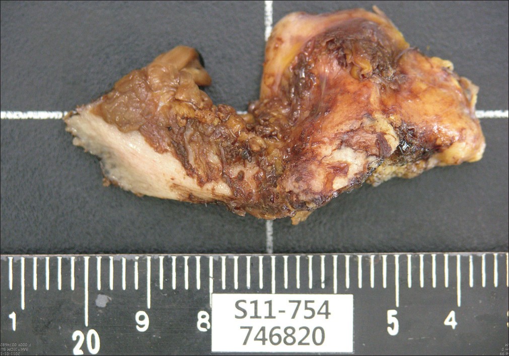 Figure 5: Gross appearance of specimens after removal