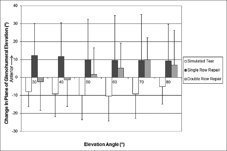 Figure 2: Change in plane of glenohumeral elevation from the intact state as a function of elevation angle for all states. Mean (±1 SD) for all specimens presented for 30° to 80° of elevation