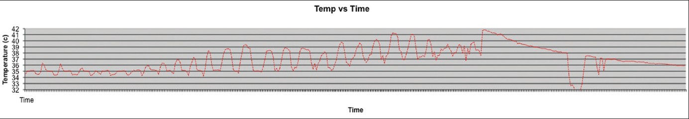 Figure 3: Temperature during reaming and subsequent saline irrigation
