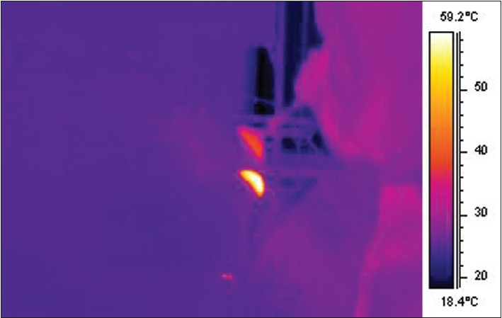Figure 4: Calibrated infra-red thermal image during reaming on the sawbone model