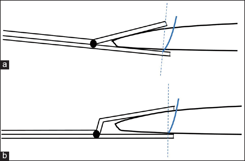 Figure 8: A side-view diagram of the grasping components of two antegrade suture passing devices: (a) Without offset, and (b) with offset. The dotted line shows a desired needle projection perpendicular to the inferior arm and shaft of the device. However, we commonly observed the needle penetrate the tendon distal to the grasping window, as represented by thesolid line. In a thick tendon as illustrated in this diagram, even when the needle penetrates perpendicular to the device it travels obliquely through the tendon and exits distal to the superior arm of the grasper. This effect is less when using devices with offset grasping arms (B)