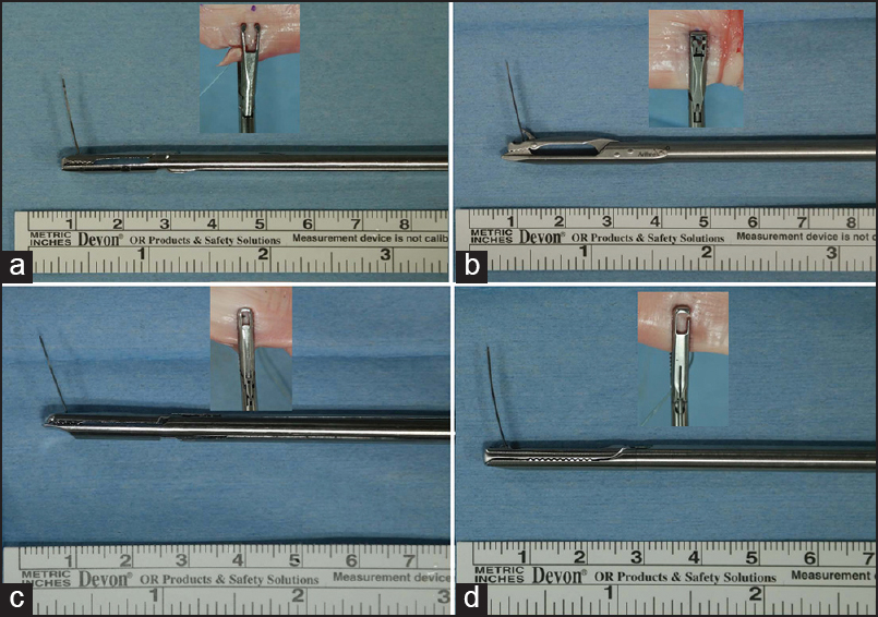 Figure 2: Images show the tip of each suture passer with needle, and the small images show a superior view of the tip's grasping arm during needle penetration of a tendon: (a) ExpresSew II, (b) Arthrex Scorpion, (c) Concept, and (d) ElitePass. The superior grasping arms of devices A and B were offset to the shaft (hump back design), although device B had a much larger offset. Device A also had an opening at the front of the superior arm of the grasping component (small fi gure). Also note that the angle the needle projects relative to the shaft of the device is the least perpendicular in device C
