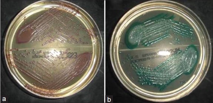Figure 1: (a) Pink colored colonies of <i>Escherichia coli</i> on chromID extended-spectrum beta-lacatamase medium and (b) green colored colonies of methicillin resistant <i>Staphylococcus aureus</i> (MRSA) on chromID MRSA medium