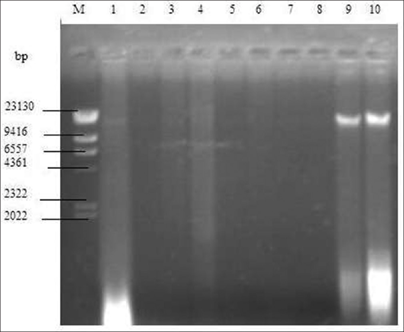 Figure 1: Agarose gel of plasmid DNA showing the presence (lanes 9 and 10) and absence (lanes 1-8) of plasmid bands lane M: hind III DNA standard marker, lane 1 -<i>Aspergillus fumigatus</i> dumpsite soil (DS)-49, lane 2 -<i>A. fumigatus</i> control soil (CS)-50, lane 3 -<i>Aspergillus niger</i> CS-51, lane 4 -<i>A. niger</i> DS-52, lane 5 -<i>Candida subtilis</i> DS-53, lane 6 -<i>C. subtilis</i> CS-54, lane 7 -<i>Staphylococcus aureus</i> Cb-23, lane 8 -<i>S. aureus</i> DS-24, lane 9 -<i>Escherichia coli</i> DS-21, lane 10 -<i>E. coli</i> CS-22