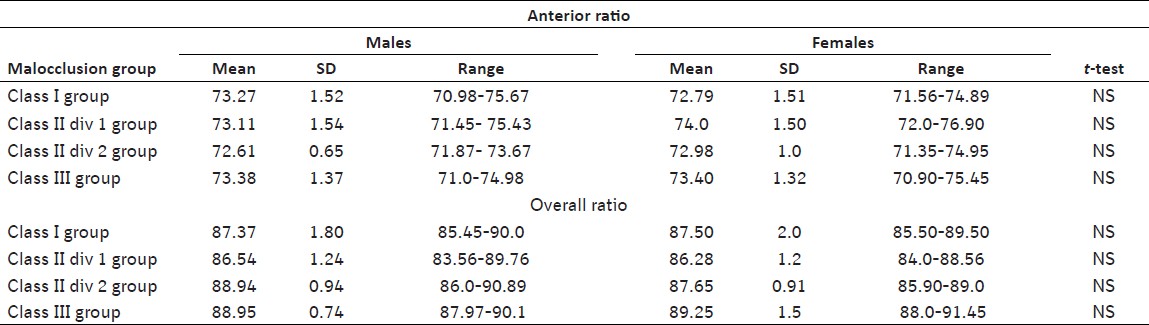Table 3: Bolton's anterior and overall tooth size ratios for both males and females with different malocclusion groups