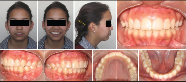 Figure 7: Photographs after 2 years of treatment