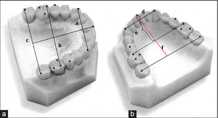 Figure 1: Dental Arch Dimensions; (a) Arch width; a: inter-canine distance; b: inter-first molar distance; c: inter-second molar distance; (b) Arch length; d: anterior arch length; e: molar-vertical distance; f: total arch length