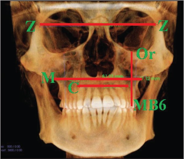 Figure 2: Frontal view
