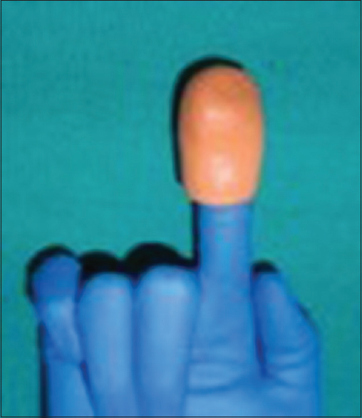 Figure 3: Dental putty loaded on the index finger