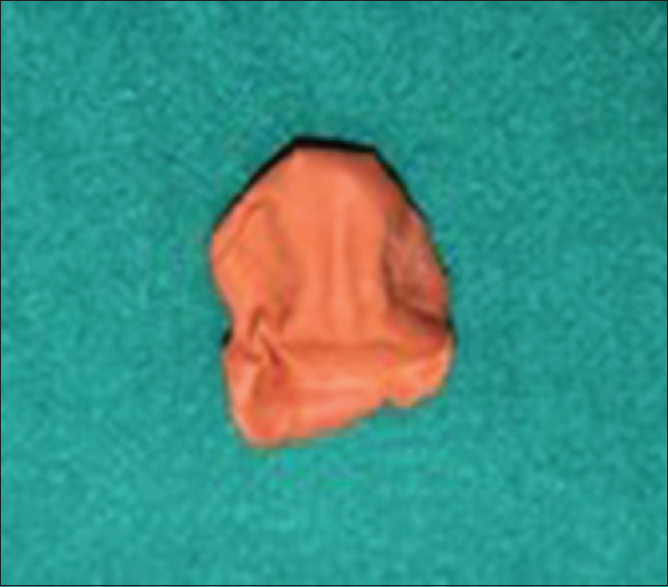 Figure 7: Dental putty maxillary impression