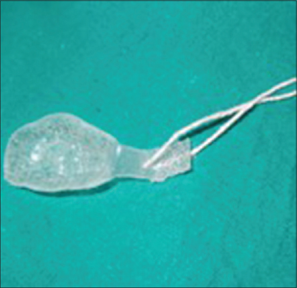 Figure 9: Clear soft feeding obturator with safety thread attached