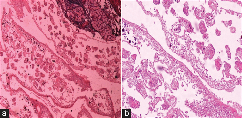 Figure 2: Scolices of echinococcus, Hematoxylin and Eosin staining (a) ×10 magnification (b) ×40 magnification
