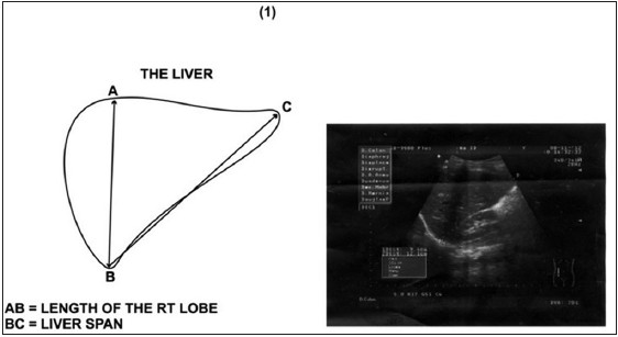 Figure 1: Picture and diagram showing how the right liver lobe and liver span were measured