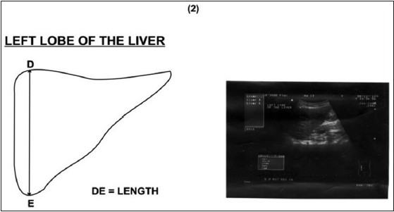 Figure 2: Picture and diagram showing how the left liver lobe was measured