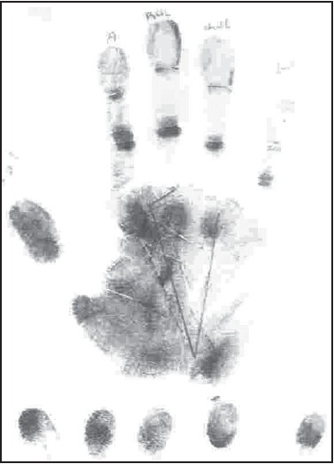 Figure 1: Left hand palm print of a male Yoruba