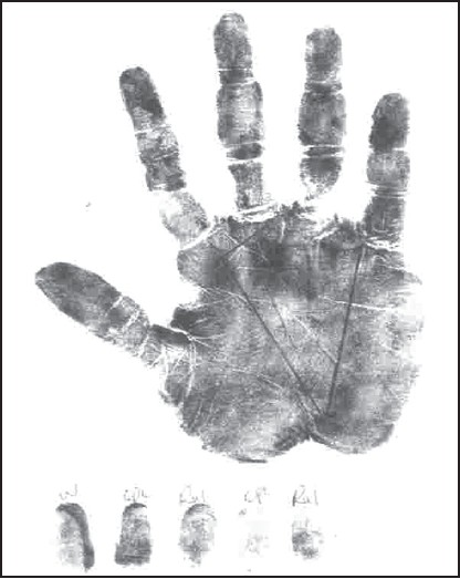 Figure 2: Right hand palm print of a female Yoruba