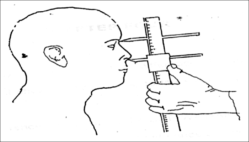 Figure 1: Measuring nasal height
