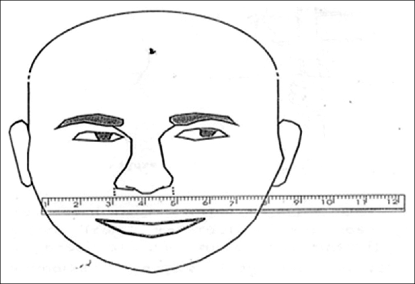 Figure 2: Measuring nasal width