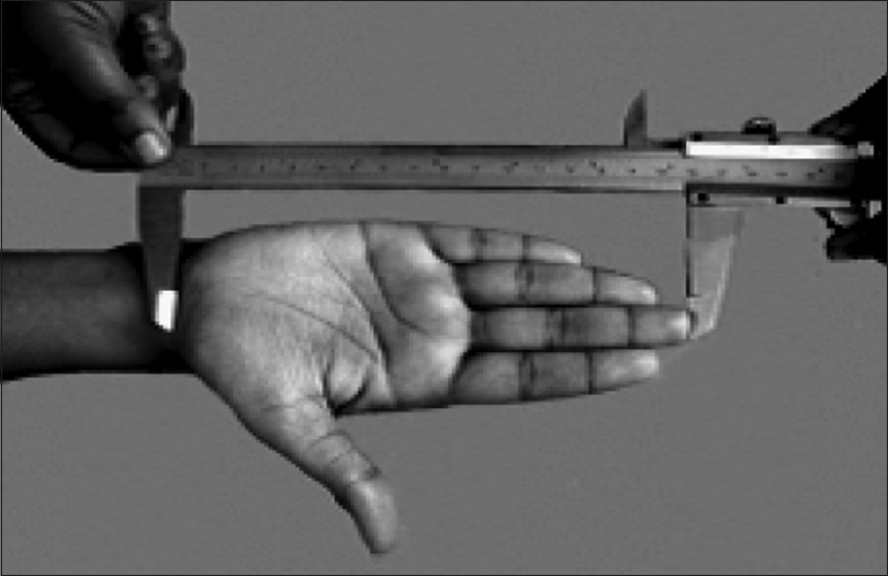 Figure 2: Measurement of hand length