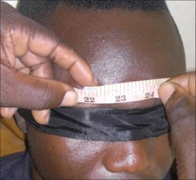 Figure 2: Measurement of head circumference